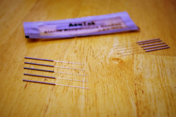 Acupuncture