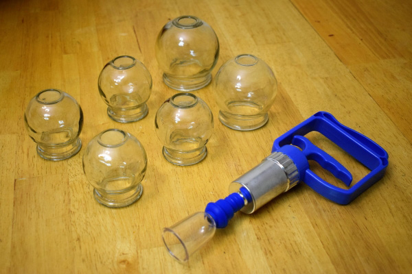 Cupping